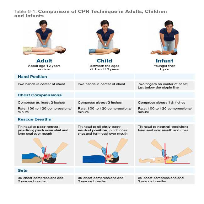 A comparison table of CPR technique in adults, children and infants.